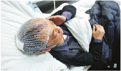 11月25日下午,湖南省脑科医院,周伟(化名)头部包扎了纱布,躺在病床上